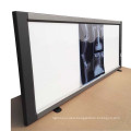 Super-Thin LED China View Box X-ray Film Illuminator